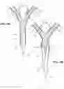 Fig. 09 - Delivery system for a bifurcated stent