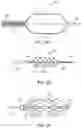 Fig. 10 - Methods of intracerebral implant delivery