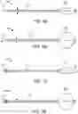 Fig. 17 - Methods of intracerebral implant delivery