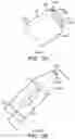 Fig. 23 - Methods of intracerebral implant delivery