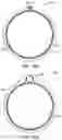 Fig. 29 - Methods of intracerebral implant delivery