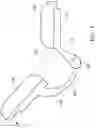 Fig. 05 - Elbow Orthosis