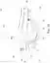 Fig. 09 - Elbow Orthosis