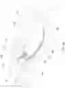 Fig. 14 - Elbow Orthosis