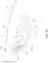 Fig. 15 - Elbow Orthosis