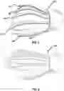 Fig. 02 - Methods and systems for treating hand tremors