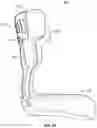 Fig. 04 - 3D-printed Strap Channel for an Orthopedic or Prosthetic Device
