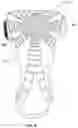 Fig. 09 - 3D-printed Strap Channel for an Orthopedic or Prosthetic Device