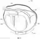 Fig. 10 - 3D-printed Strap Channel for an Orthopedic or Prosthetic Device