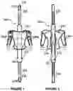 Fig. 02 - Posture Correcting Apparatus