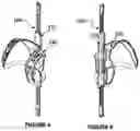 Fig. 04 - Posture Correcting Apparatus