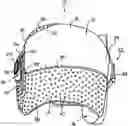Fig. 01 - Prefabricated Customizable Cranial Remodelling Orthotic