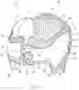 Fig. 02 - Prefabricated Customizable Cranial Remodelling Orthotic