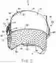 Fig. 04 - Prefabricated Customizable Cranial Remodelling Orthotic