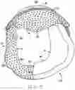 Fig. 06 - Prefabricated Customizable Cranial Remodelling Orthotic