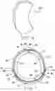 Fig. 07 - Prefabricated Customizable Cranial Remodelling Orthotic