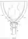 Fig. 03 - Hannah cervical cup