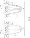 Fig. 07 - Hannah cervical cup