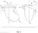 Fig. 08 - Hannah cervical cup