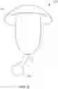 Fig. 09 - Hannah cervical cup