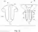 Fig. 11 - Hannah cervical cup