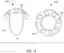 Fig. 16 - Hannah cervical cup