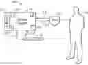 Fig. 01 - Proximal Mounting of Temperature Sensor in Intravascular Temperature Management Catheter
