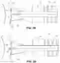 Fig. 04 - Methods and Probes for Intrascleral Laser Surgery