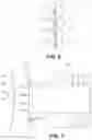 Fig. 06 - Methods and Probes for Intrascleral Laser Surgery