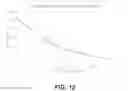 Fig. 11 - Methods and Probes for Intrascleral Laser Surgery