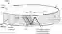 Fig. 01 - Lasik flap cutting patterns including intrastromal pocket for bubble management