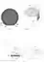 Fig. 05 - Lasik flap cutting patterns including intrastromal pocket for bubble management