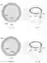 Fig. 08 - Lasik flap cutting patterns including intrastromal pocket for bubble management