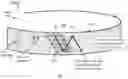 Fig. 10 - Lasik flap cutting patterns including intrastromal pocket for bubble management