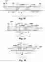 Fig. 11 - Pressure applying dressing
