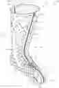 Fig. 01 - Thermoformable orthosis apparatus and method of use