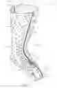 Fig. 02 - Thermoformable orthosis apparatus and method of use