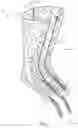 Fig. 08 - Thermoformable orthosis apparatus and method of use
