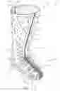 Fig. 14 - Thermoformable orthosis apparatus and method of use