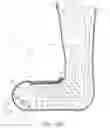 Fig. 19 - Thermoformable orthosis apparatus and method of use