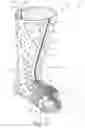 Fig. 24 - Thermoformable orthosis apparatus and method of use