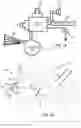 Fig. 09 - DEVICES AND METHODS FOR ELEVATED CARDIOPULMONARY RESUSCITATION