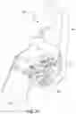 Fig. 17 - Wheelchair for improved muscular skeletal system alignment