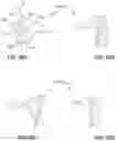 Fig. 20 - Wheelchair for improved muscular skeletal system alignment