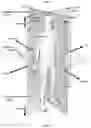 Fig. 21 - Systems and Methods for Relieving Nerve Tension in Scoliosis