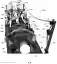 Fig. 35 - Systems and Methods for Relieving Nerve Tension in Scoliosis
