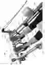 Fig. 36 - Systems and Methods for Relieving Nerve Tension in Scoliosis