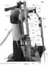 Fig. 42 - Systems and Methods for Relieving Nerve Tension in Scoliosis