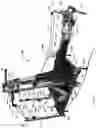 Fig. 44 - Systems and Methods for Relieving Nerve Tension in Scoliosis
