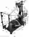 Fig. 46 - Systems and Methods for Relieving Nerve Tension in Scoliosis